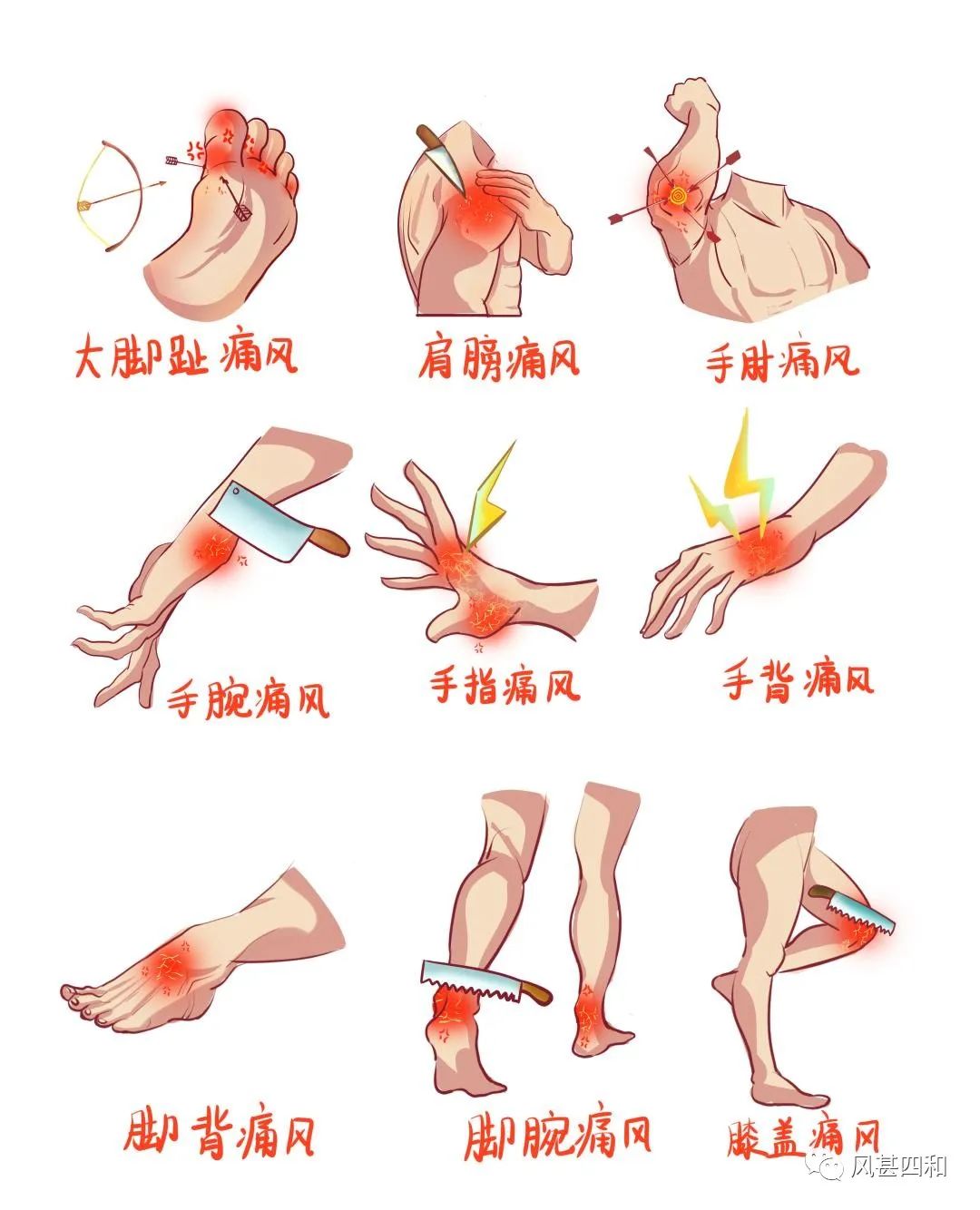 图片展示了不同部位的痛风疼痛示例,包括大脚趾、肩膀、手肘、手腕、手指、手背、脚背、脚腕、膝盖等。各部位以图示呈现,疼痛处用红色突出显示,部分还配有形象化的疼痛示意图案。此图与文档中“根据疼痛的部分判断”这一痛风自测方法相对应,直观地呈现了痛风可能发作疼痛的身体部位,帮助读者更清晰地理解痛风疼痛在身体上的具体位置,辅助进行痛风自测。