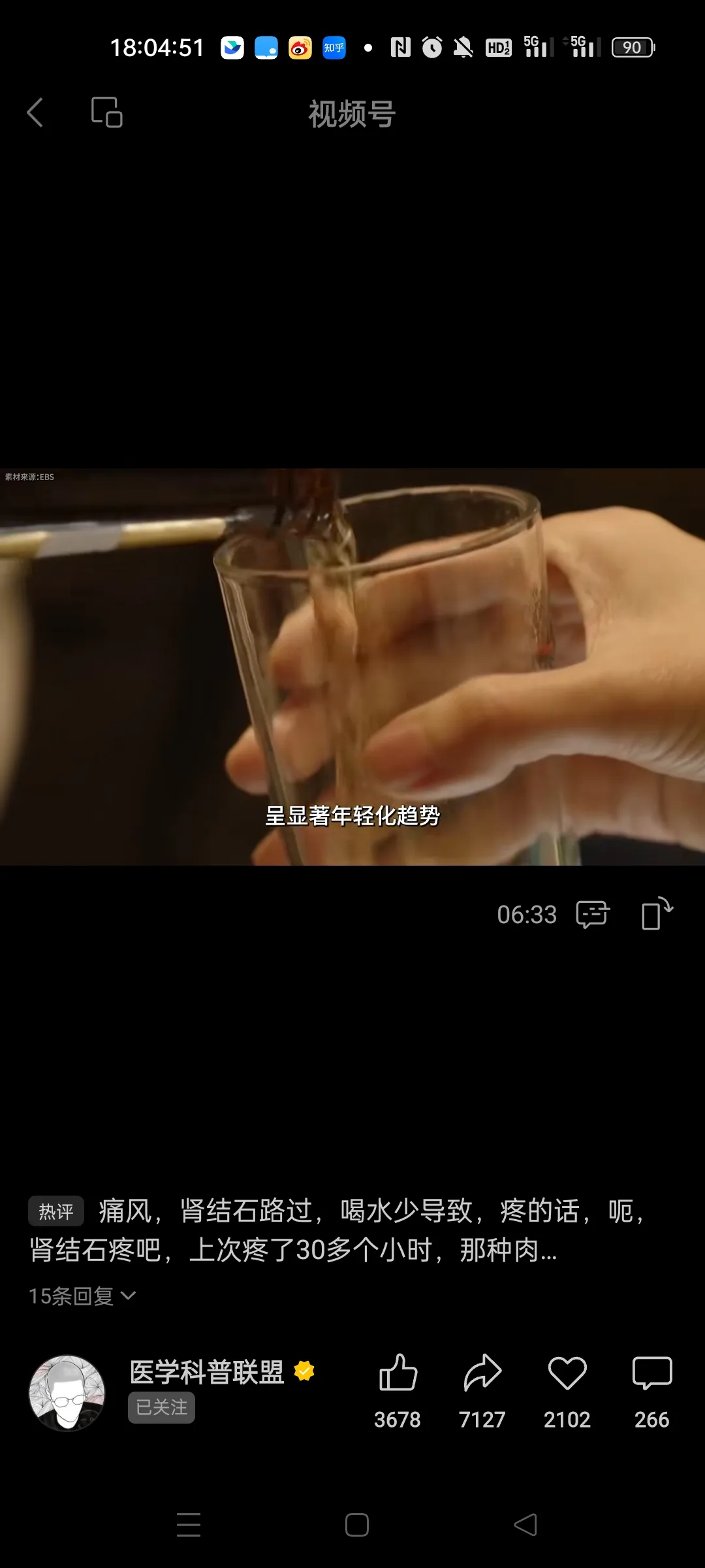 图片展示的是医学科普联盟抖音号发布的视频号内容。画面中一只手正用吸管向玻璃杯中倒入液体,下方文字提示“呈 addCriterion呈显著年轻化趋势”。视频时长显示为06:33。下方评论区有“痛风、肾结石路过,喝水少导致,疼的话 addCriterion痛风、肾结石路过,喝水少导致,疼的话,呃,肾结石疼吧,上次疼了30多个小时,那种肉...”等内容。该图片与文档中介绍医学科普联盟的内容相关,展示了其发布的内容样式。